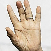 Hand 4